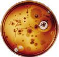 Mold Spores and Fungi