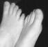 Feet